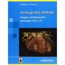 Imagen Cardiovascular Avanzada: RM y TC "Monografía SERAM"