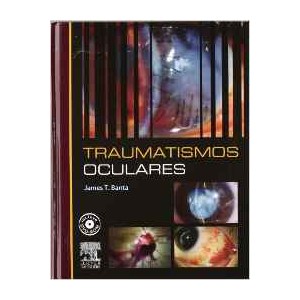 Traumatismos Oculares "Incluye DVD"