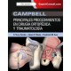 Campbell. Principales procedimientos en cirugía ortopédica y traumatología + Acceso Online