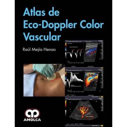 Atlas de Eco-Doppler Color Vascular - Mejia