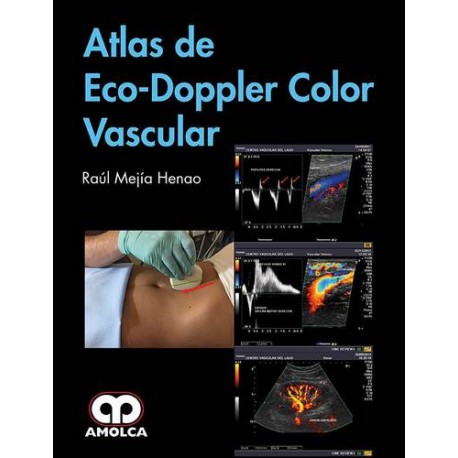 Atlas de Eco-Doppler Color Vascular - Mejia
