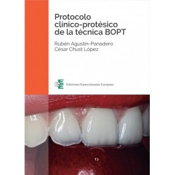 Protocolo clínico-protésico de la técnica BOPT