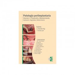 Patología Periimplantaria. Prevención y Mantenimiento