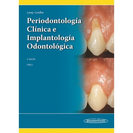 Periodontología Clínica e Implantología Odontológica Tomo 2