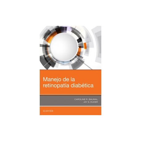 Manejo de la retinopatía diabética