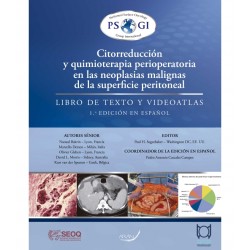 Citorreducción y Quimioterapia Perioperatoria en las Neoplasias Malignas de la Superficie Peritoneal