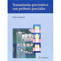 Tratamiento preventivo con prótesis parciales