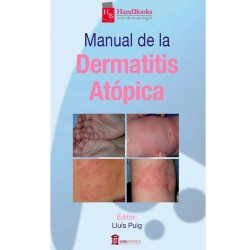Manual de la dermatitis atópica