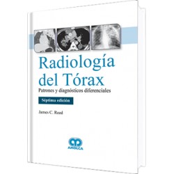 Radiología del Tórax. Patrones y Diagnósticos Diferenciales