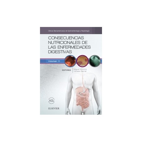 Consecuencias nutricionales de las enfermedades digestivas: Clínicas Iberoamericanas de Gastroenterología y Hepatología vol.11