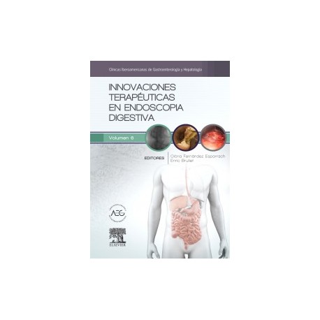 Innovaciones terapéuticas en endoscopia digestiva: Clínicas Iberoamericanas de Gastroenterología y Hepatología vol. 6