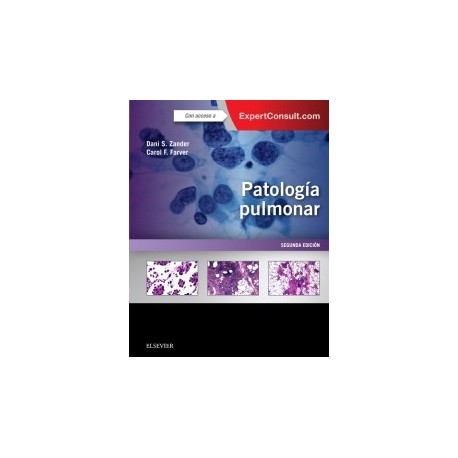 Patología Pulmonar 2ª edición