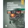 Abordajes neuroquirúrgicos de la patología craneal y cerebral