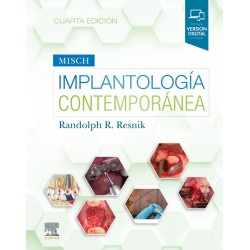 Implantología contemporánea
