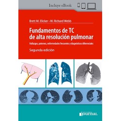 Fundamentos de TC de Alta Resolución Pulmonar. Hallazgos, Patrones, Enfermedades Frecuentes y Diagnósticos Diferenciales
