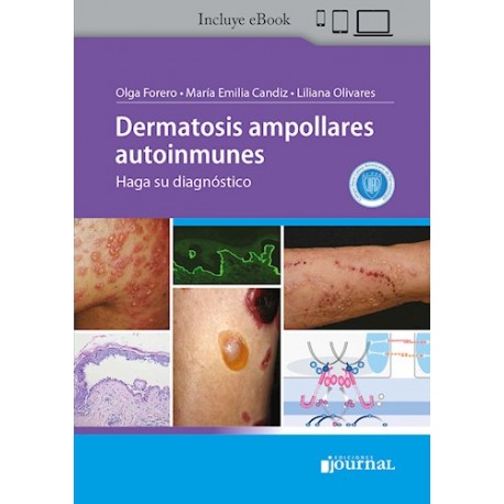 Dermatosis Ampollares Autoinmunes. Haga su Diagnóstico