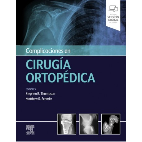  Complicaciones en cirugía ortopédica
