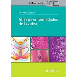 Atlas de Enfermedades de la Vulva