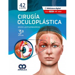 Cirugía Oculoplástica