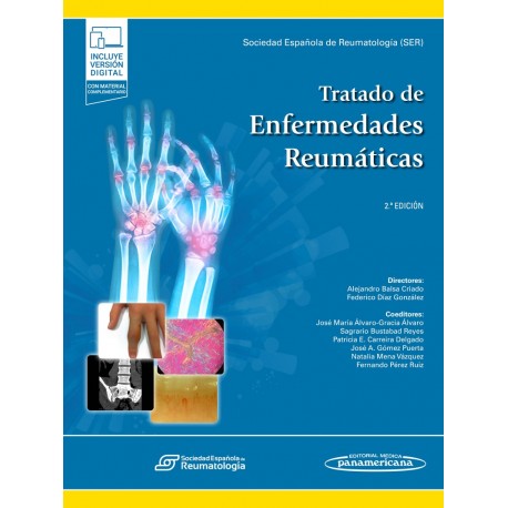 Tratado de Reumatología
