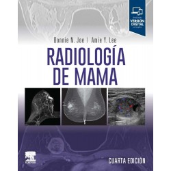Radiología de mama